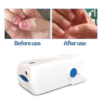 LASTEK® 905nm LLLT Nail Fungus Cold Laser Treatment Device