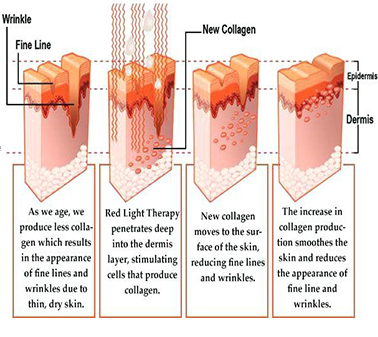 LED Infrared & Red Light Therapy 1500 Mighty